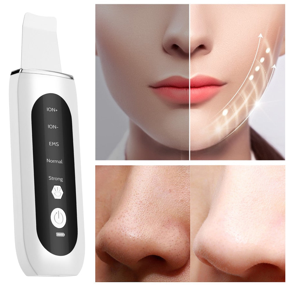 Ultrasonic Face Skin Scrubber